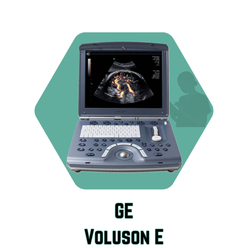 سونوگرافی GE - Voluson E